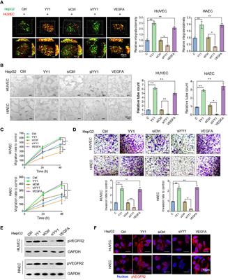 Corrigendum: YY1 Promotes Endothelial Cell-Dependent Tumor Angiogenesis in Hepatocellular Carcinoma by Transcriptionally Activating VEGFA